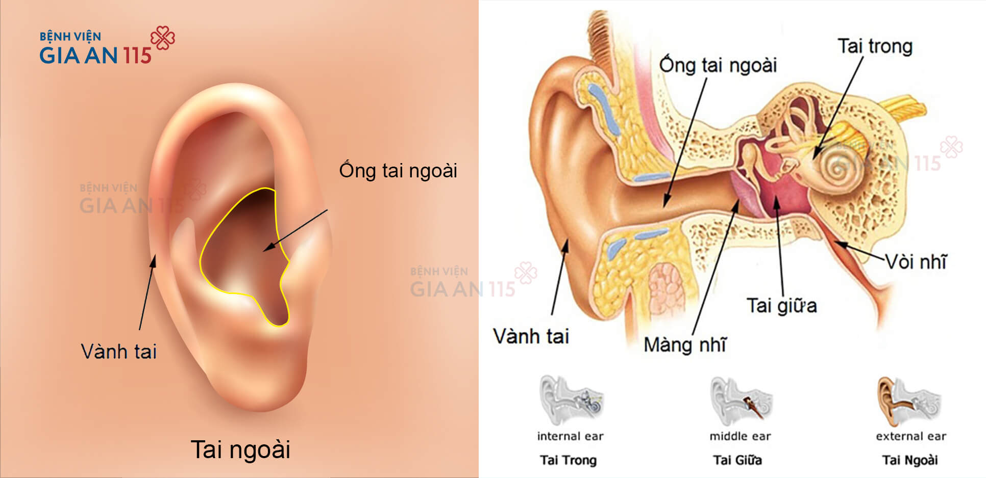 Đau nhức tai, bạn có thể đang bị nhọt ống tai ngoài có nên đi khám ...