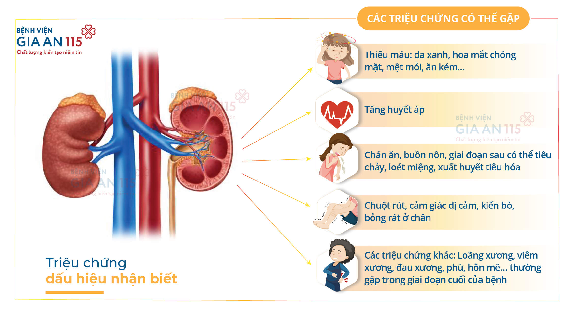 Triệu chứng dấu hiệu nhận biết về suy thận mạn