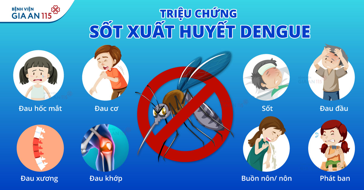 Triệu chứng sốt xuất huyết Dengue