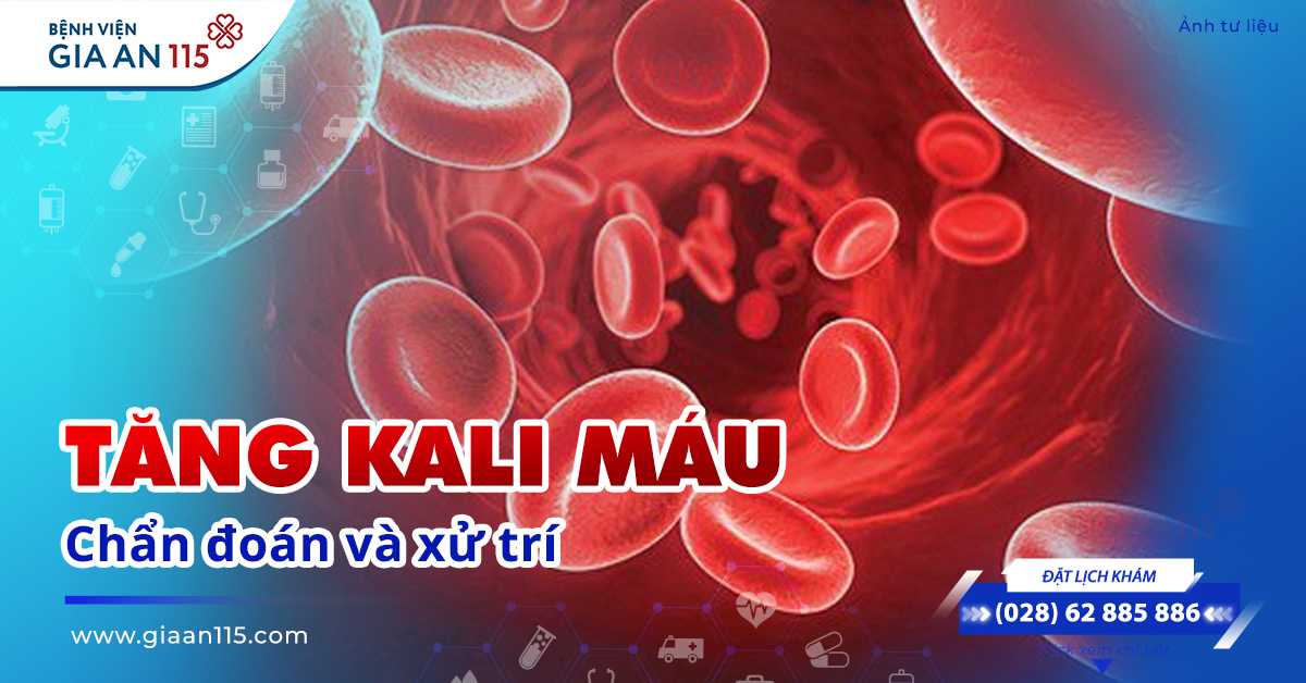 Tăng Kali máu chẩn đoán và cách xử trí