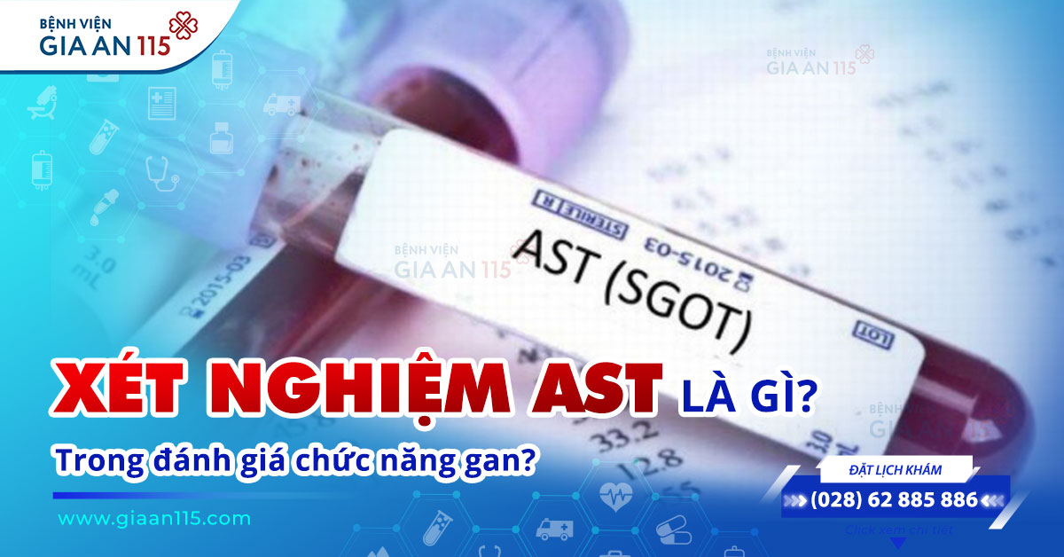 Xét nghiệm AST là gì? Ý nghĩa, cách thực hiện và giải đáp thắc mắc