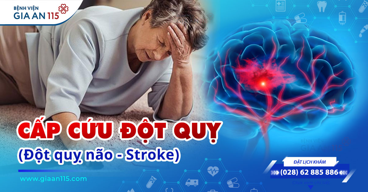 3. Các dấu hiệu và triệu chứng của đột quỵ