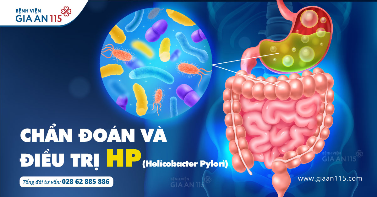 Chẩn đoán và Điều trị HP (Helicobacter Pylori)