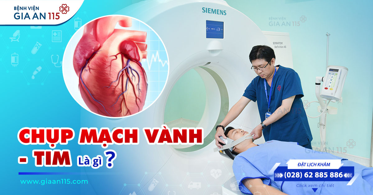 Chụp mạch vành – tim là gì?