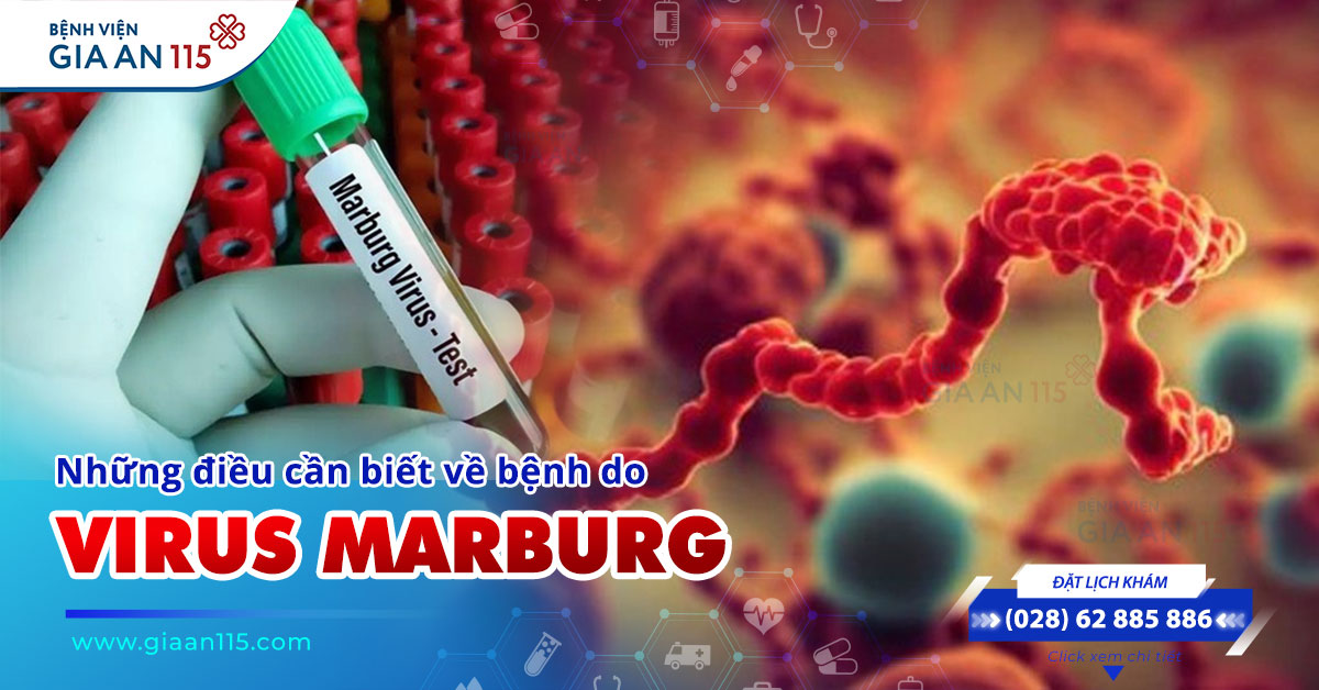 Những điều cần biết về Bệnh do virus Marburg