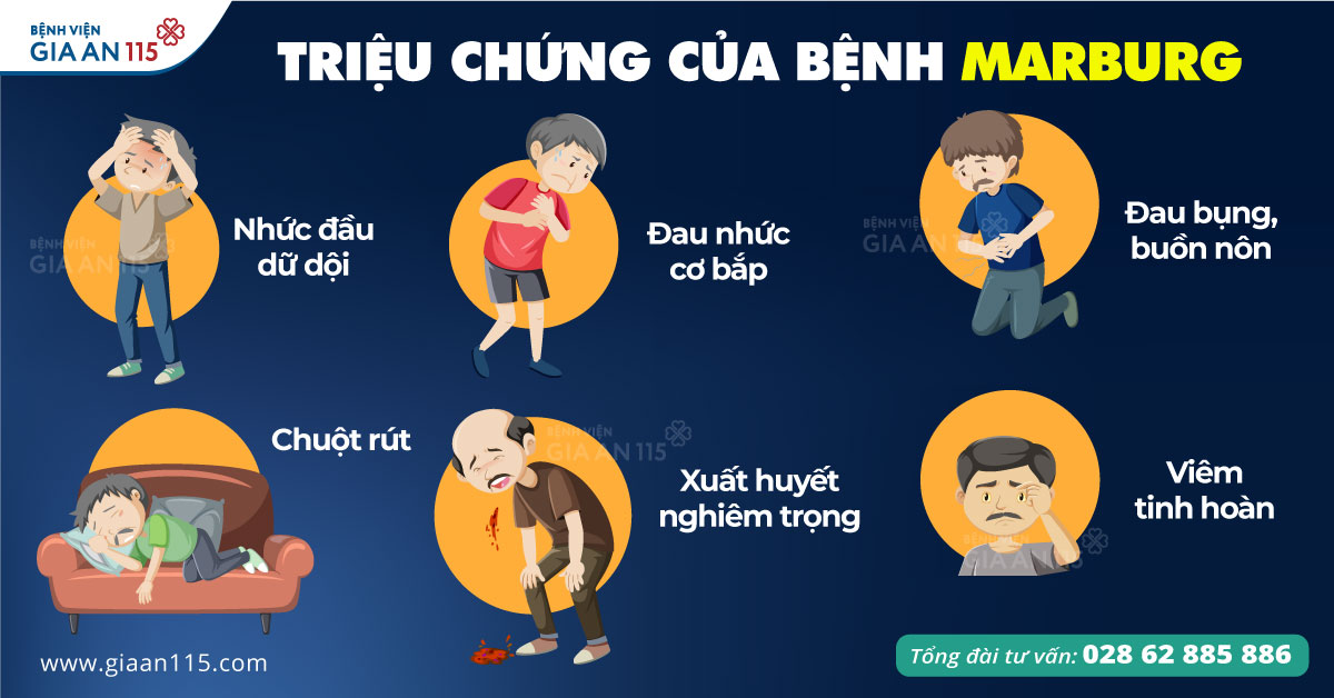 Triệu chứng của Bệnh do virus Marburg