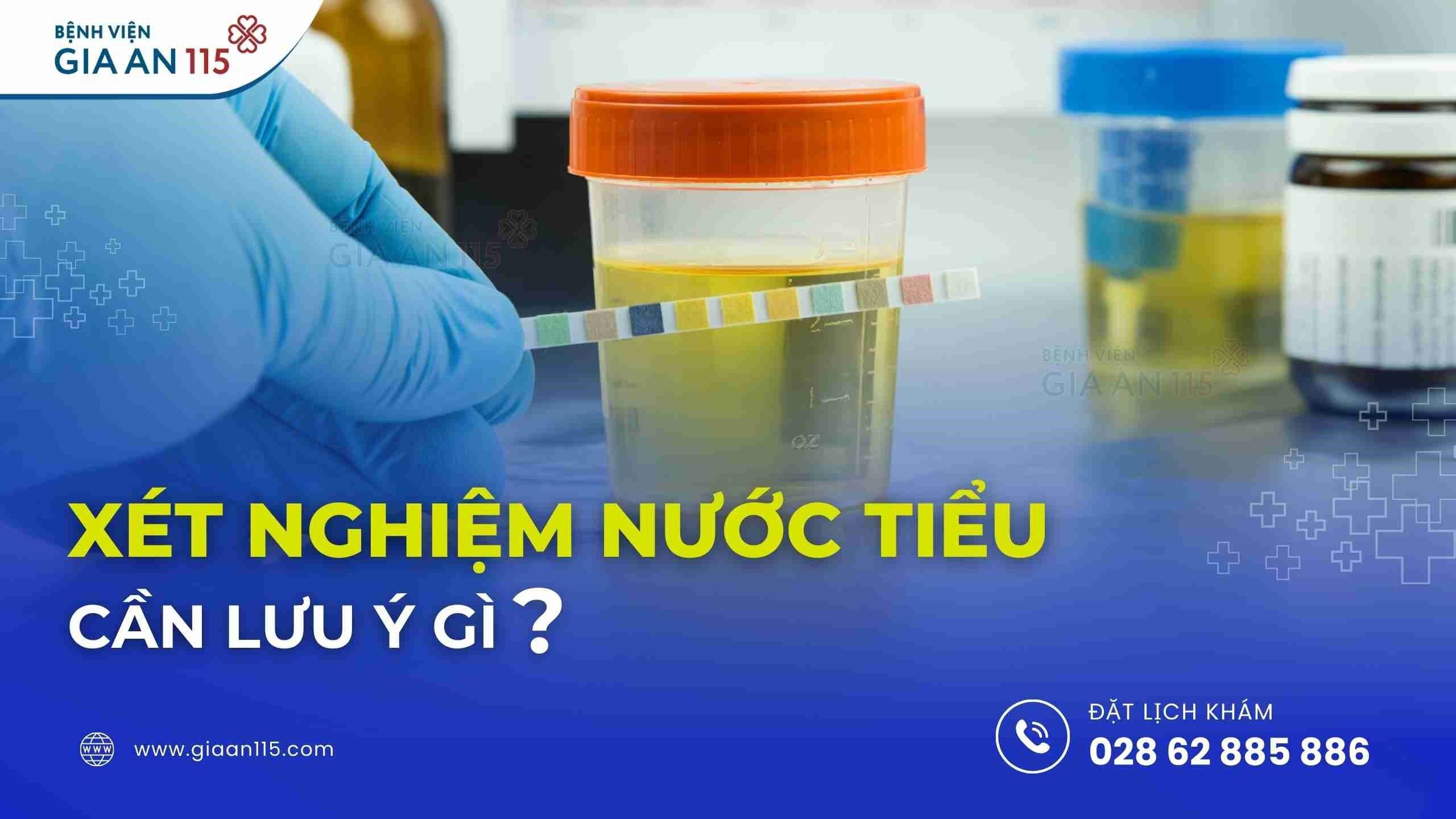 Xét nghiệm nước tiểu cần kiêng những gì?