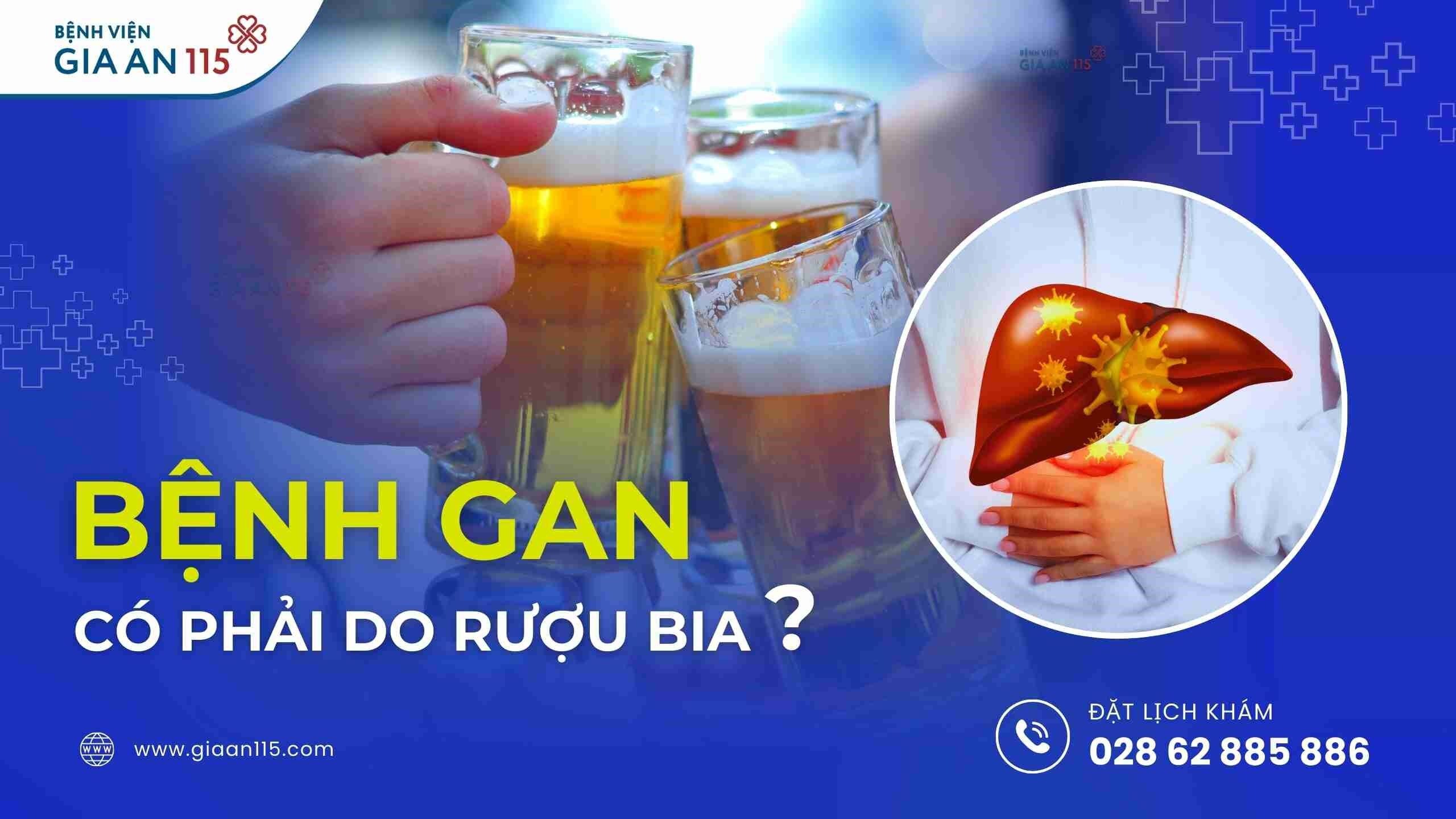 Bệnh gan có phải do rượu bia?