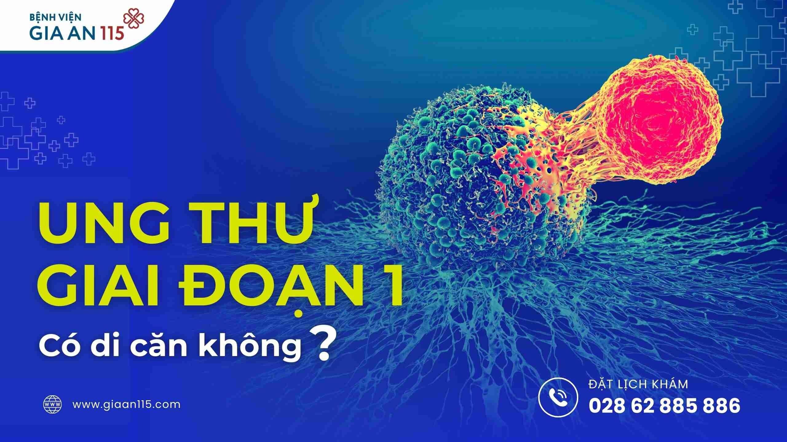 Ung thư giai đoạn 1 có di căn không?