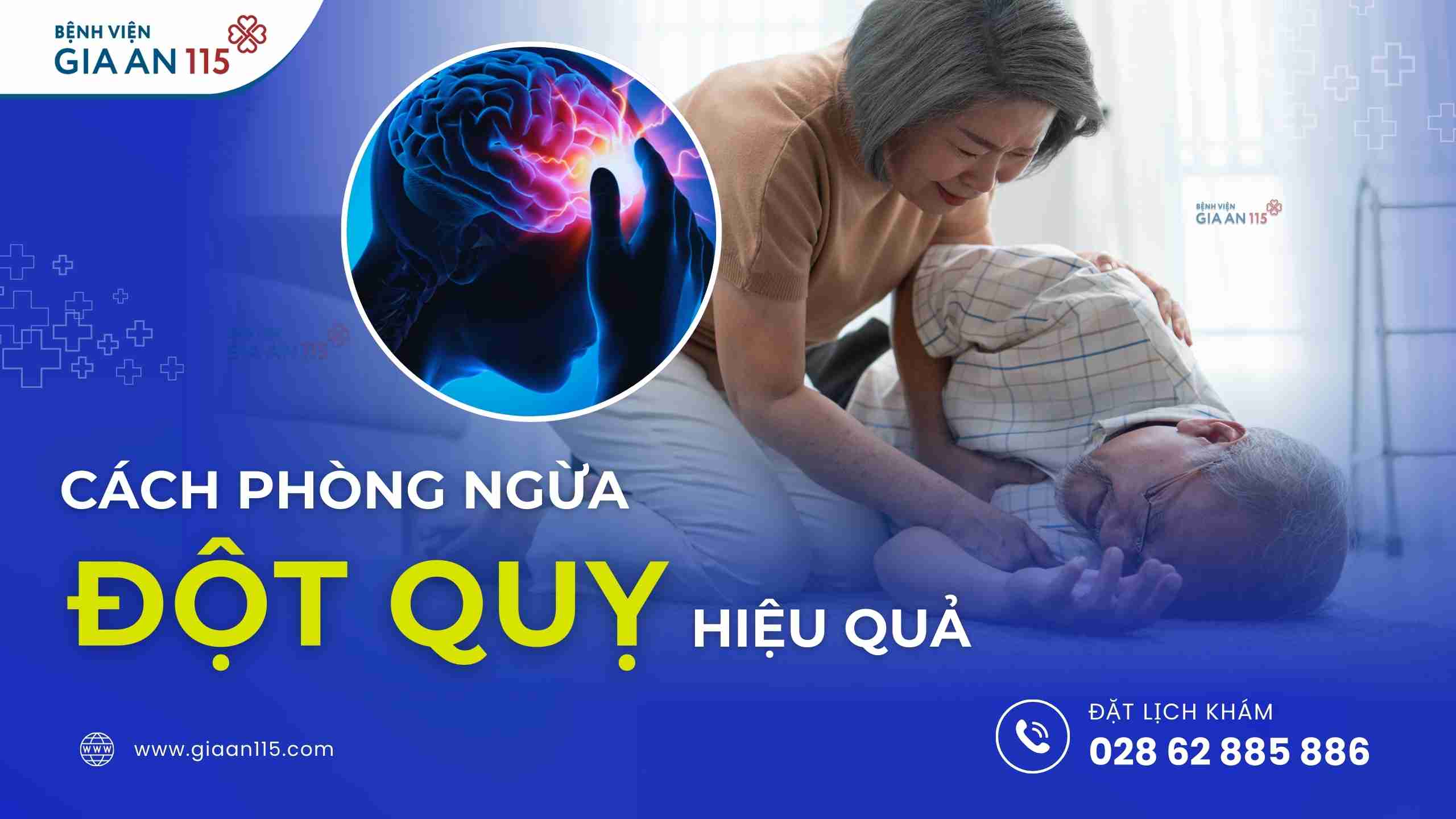 Bác sĩ tư vấn cách phòng tránh đột quỵ hiệu quả bạn cần biết