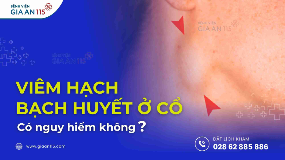 Viêm hạch bạch huyết ở cổ có nguy hiểm không?