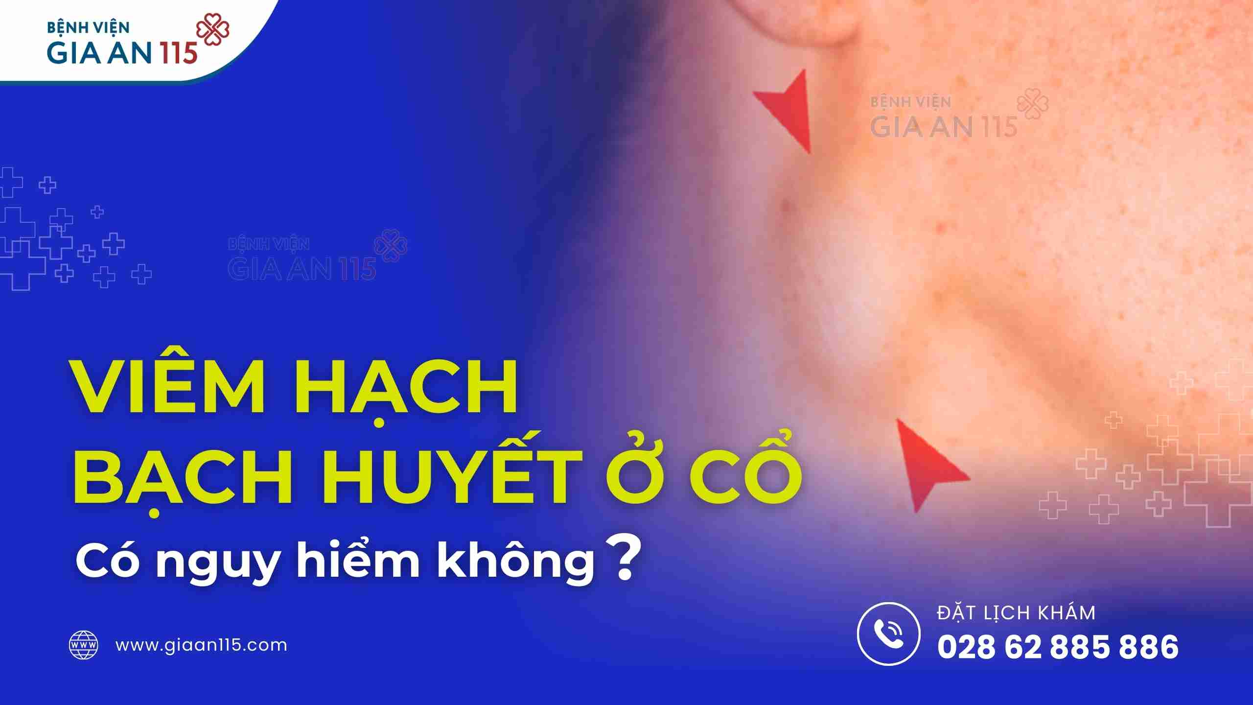 Viêm hạch bạch huyết ở cổ có nguy hiểm không? Báo hiệu bệnh gì?