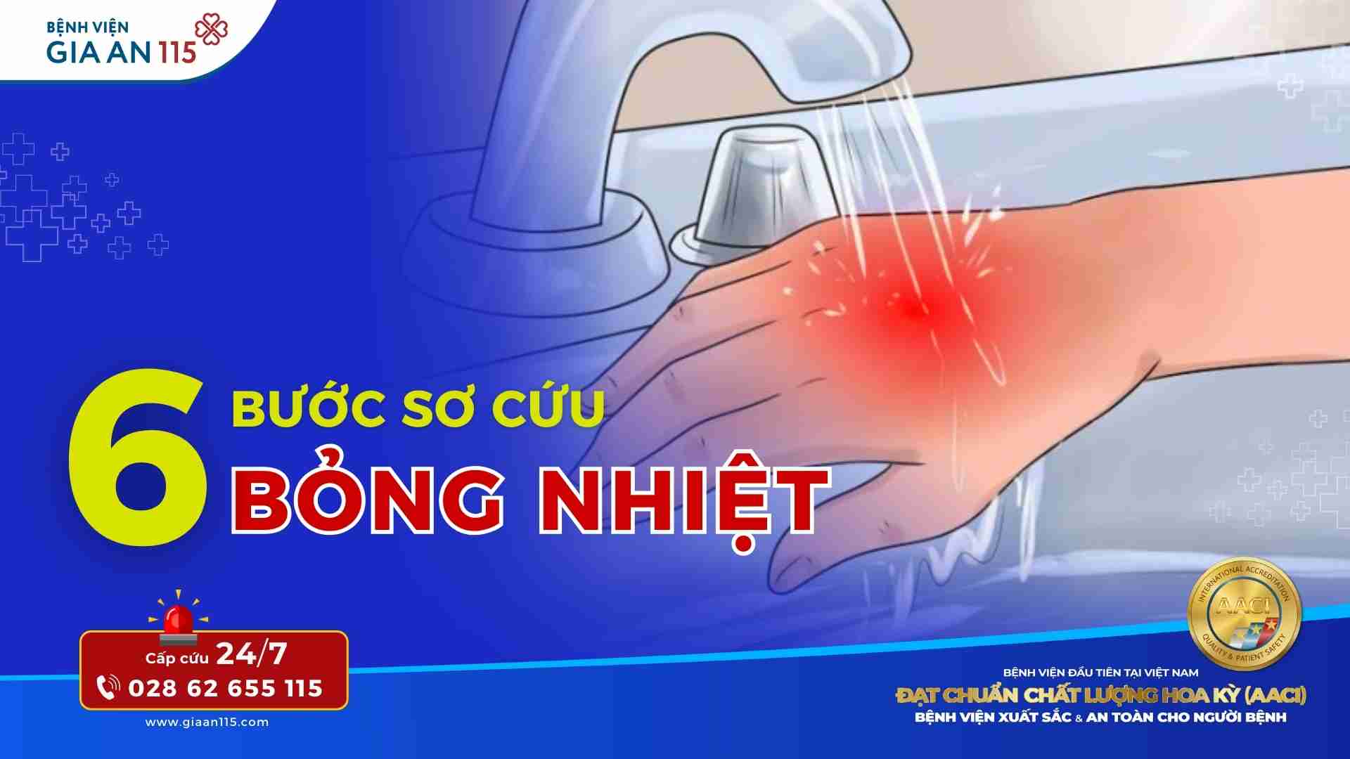 Hướng dẫn 6 bước sơ cứu, cấp cứu cho người bị bỏng nhiệt