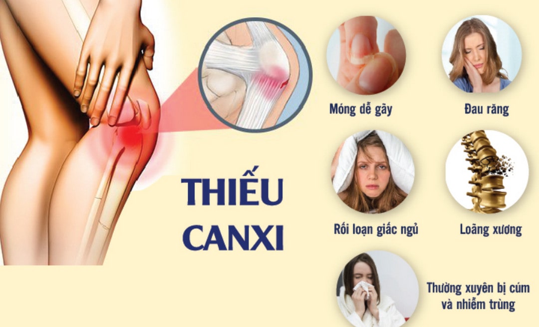 10+ Triệu chứng thiếu canxi ở người lớn và cách phòng ngừa hiệu quả