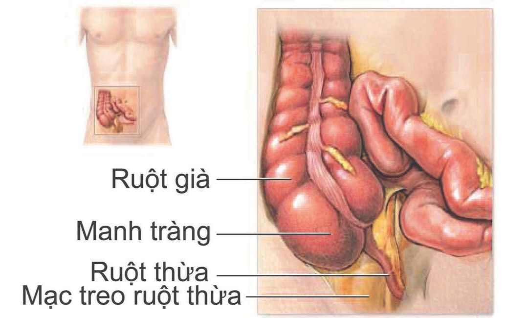 Hình ảnh ruột thừa trong cơ thể 