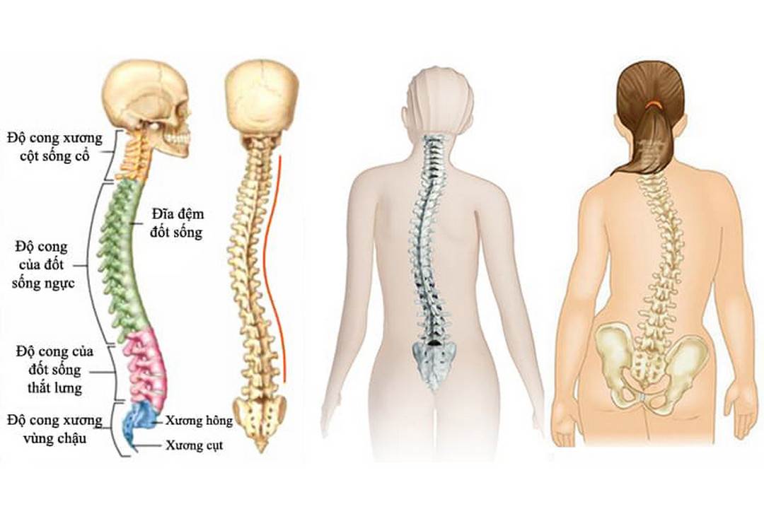 Tìm hiểu chung về tình trạng cong vẹo cột sống