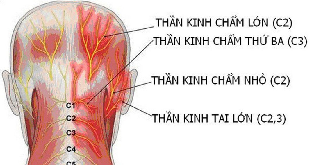 Đau dây thần kinh chẩm: Nguyên nhân, triệu chứng và cách điều trị