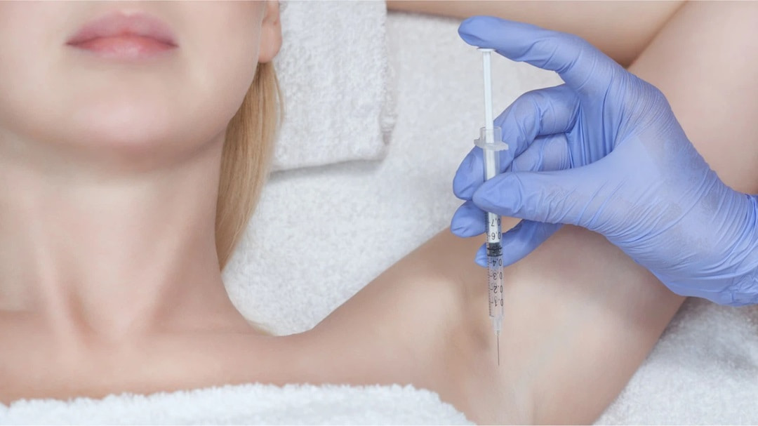 Tiêm botox cải thiện bệnh tăng tiết mồ hôi