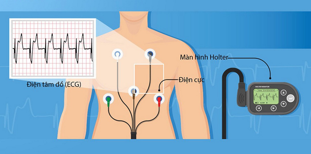 Dùng điện tâm đồ để kiểm tra hoạt động của tim