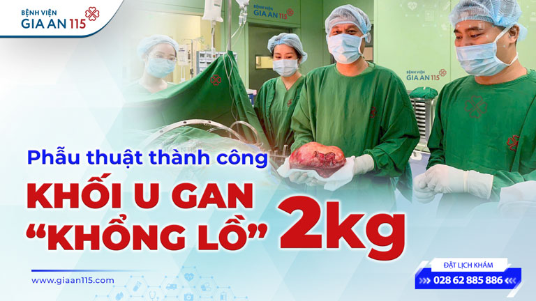 Phẫu thuật thành công khối u gan “khổng lồ” nặng 2kg