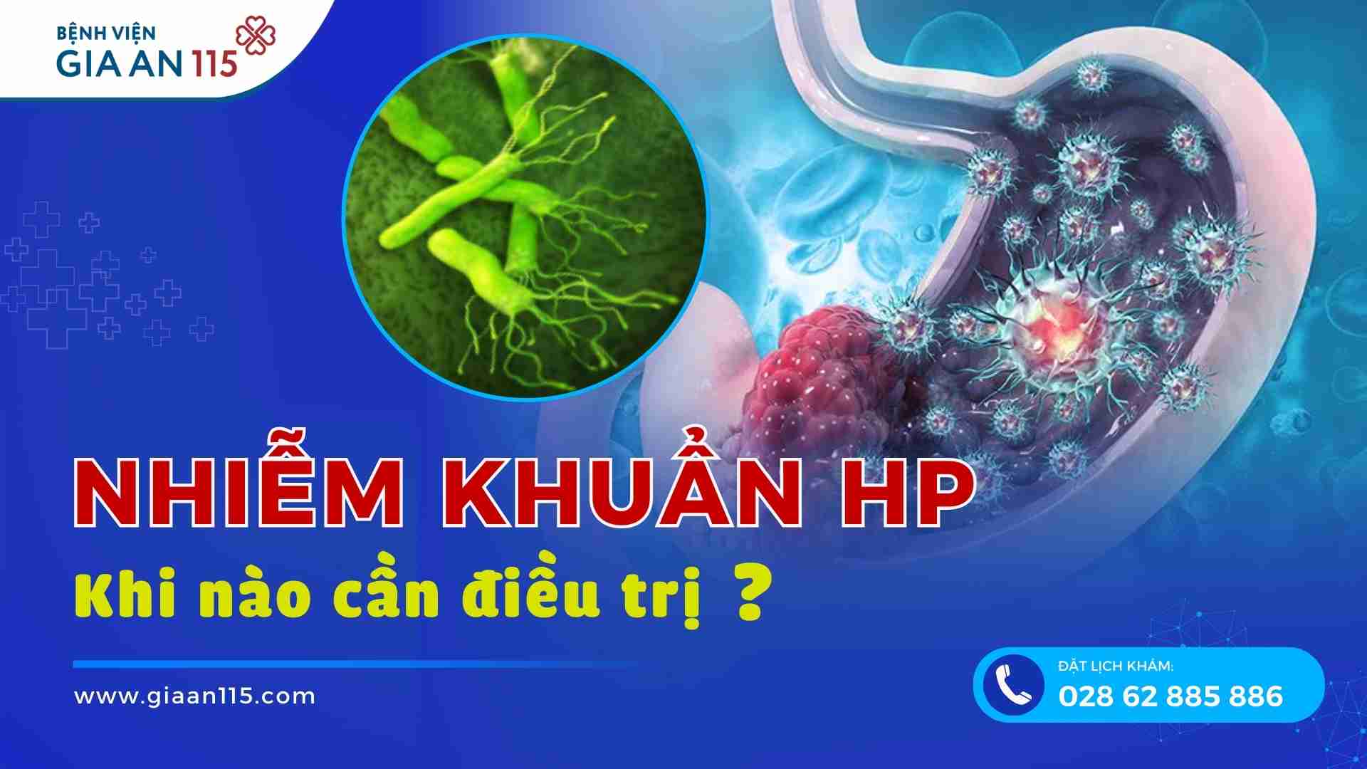 Nhiễm vi khuẩn HP, khi nào cần điều trị diệt trừ?