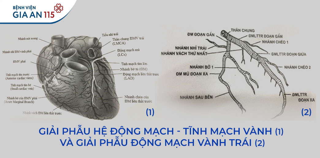 Đau thượng vị tưởng bệnh dạ dày, không ngờ tắc vị trí “hiểm” của động mạch tim