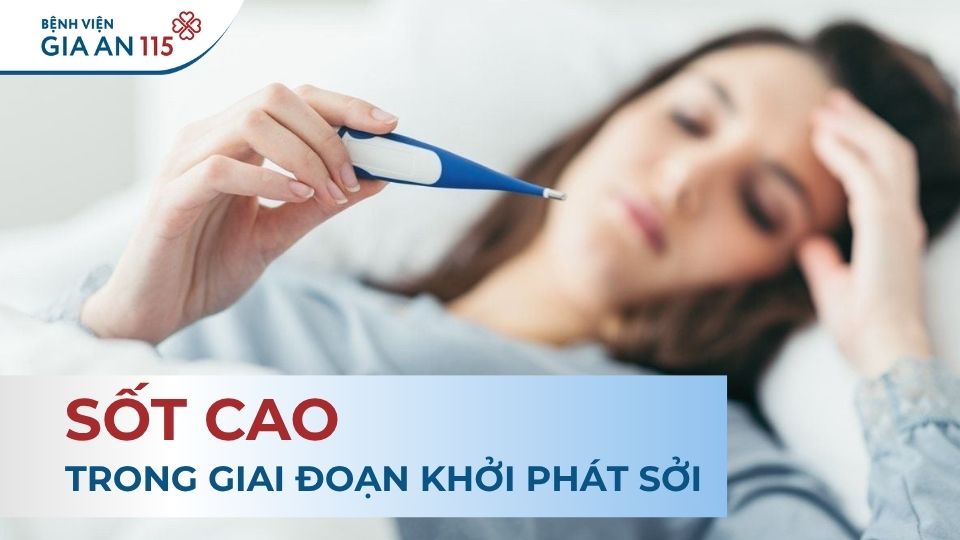 Phác đồ điều trị sởi mới nhất của Bộ Y tế cập nhật năm 2025