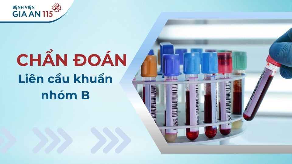Liên cầu khuẩn nhóm B là gì? Dấu hiệu cảnh báo và cách điều trị