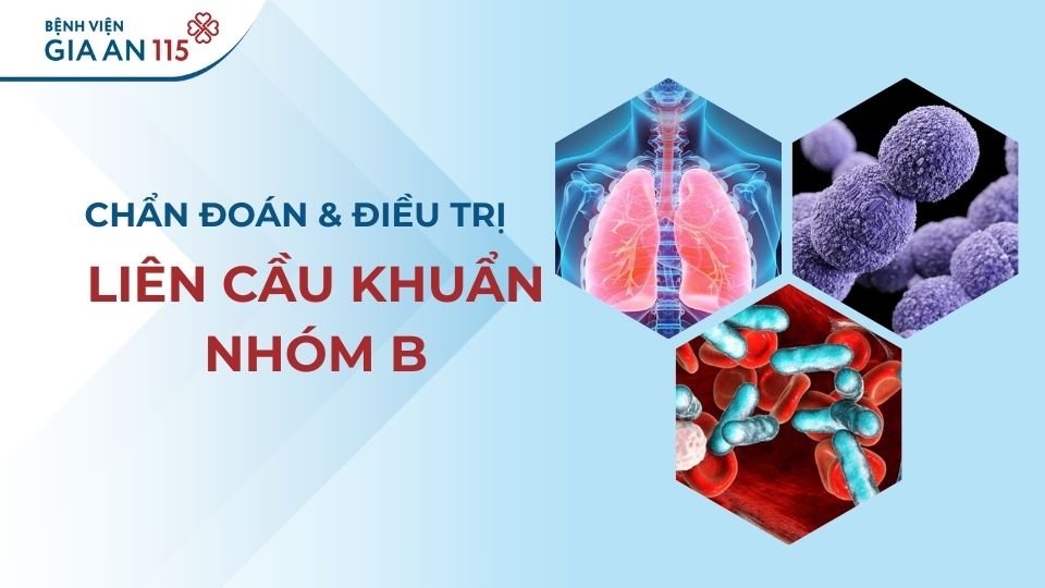 Liên cầu khuẩn nhóm B là gì? Dấu hiệu cảnh báo và cách điều trị