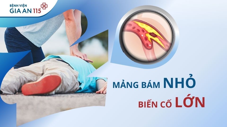 Các bệnh tim mạch thường gặp: Dấu hiệu nhận biết và thực trạng tại Việt Nam