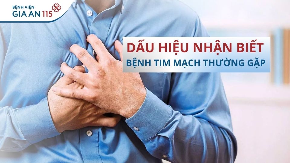 Các bệnh tim mạch thường gặp: Dấu hiệu nhận biết và thực trạng tại Việt Nam