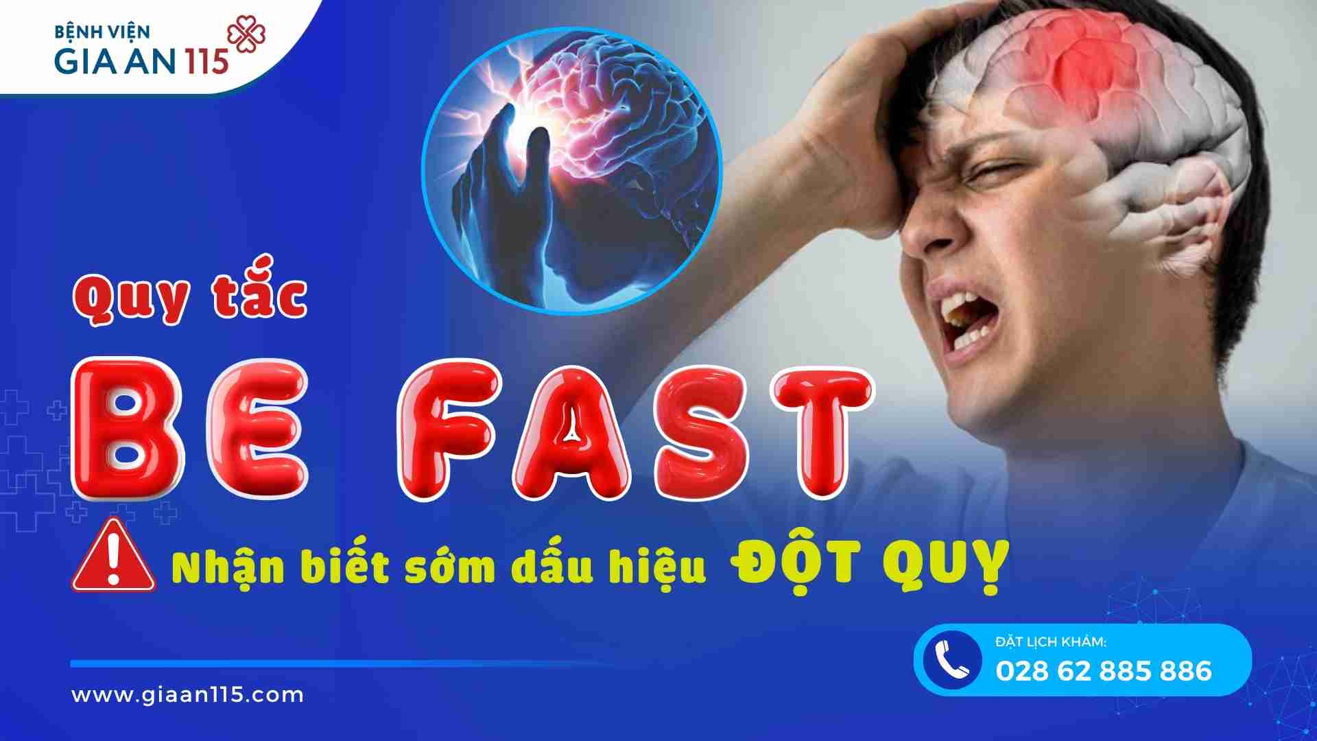 Quy tắc BE FAST - Nhận biết sớm các dấu hiệu đột quỵ