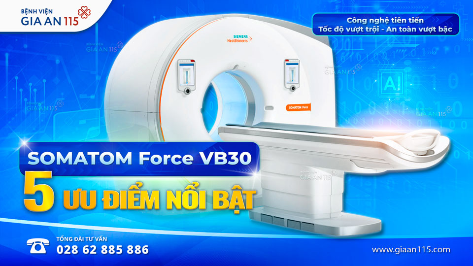 SOMATOM Force VB30: 5 ưu điểm nổi bật của siêu máy CT tại Bệnh viện Gia An 115