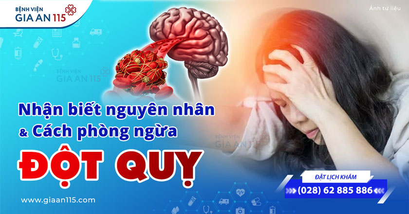 Đột quỵ thiếu máu não: Nhận biết nguyên nhân và cách phòng ngừa