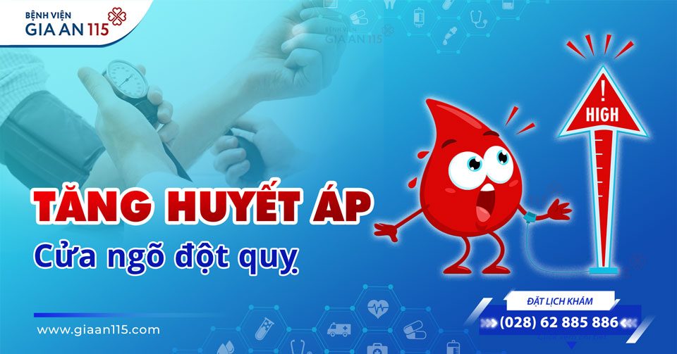 Tăng huyết áp – “Cửa ngõ” dẫn đến đột quỵ