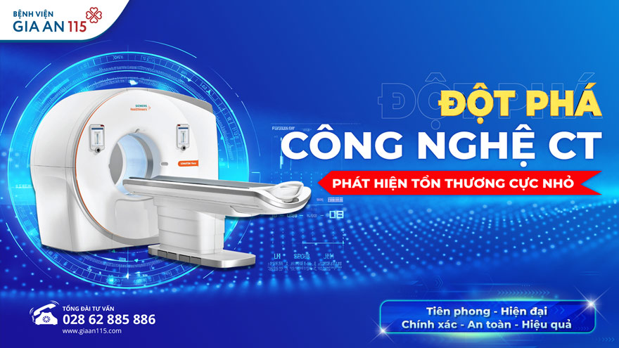 Đột phá công nghệ chụp CT: Phát hiện tổn thương cực nhỏ trong tích tắc