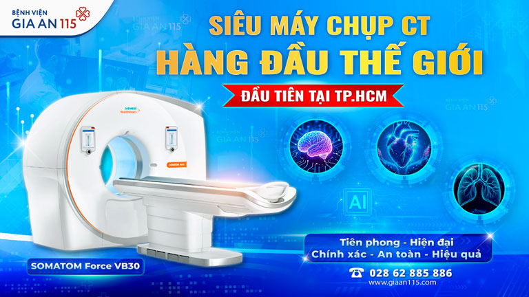 Chụp CT mạch vành: Giải pháp phát hiện sớm bệnh lý tim mạch
