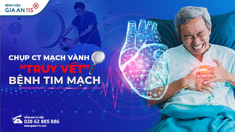 Chụp CT mạch vành: Giải pháp phát hiện sớm bệnh lý tim mạch