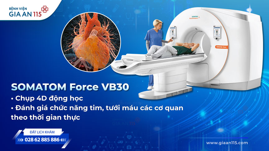 Hẹp động mạch vành: Phát hiện sớm ngăn chặn biến cố tim mạch cùng công nghệ CT tiên phong