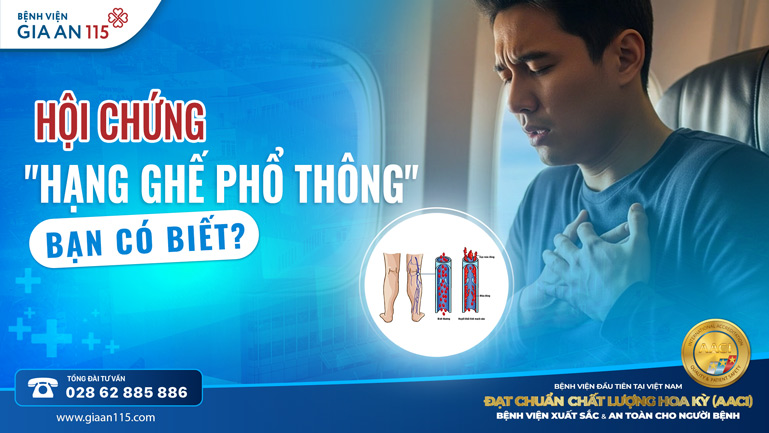 Hội chứng “hạng ghế phổ thông”: Nguy cơ huyết khối khi bay đường dài