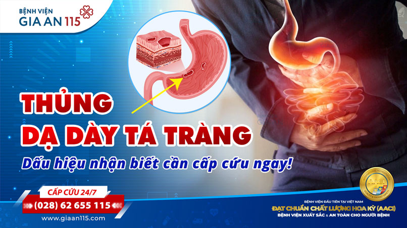 Thủng dạ dày tá tràng