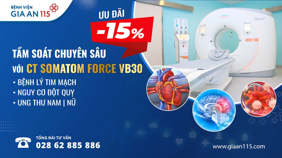 Ưu đãi 15% các gói khám tầm soát chuyên sâu có chụp CT bằng máy SOMATOM Force VB30