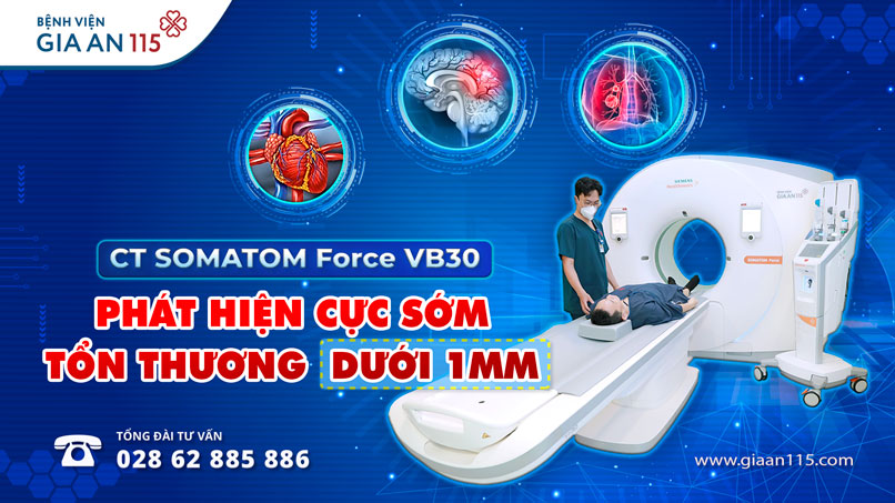 Siêu máy CT SOMATOM Force VB30