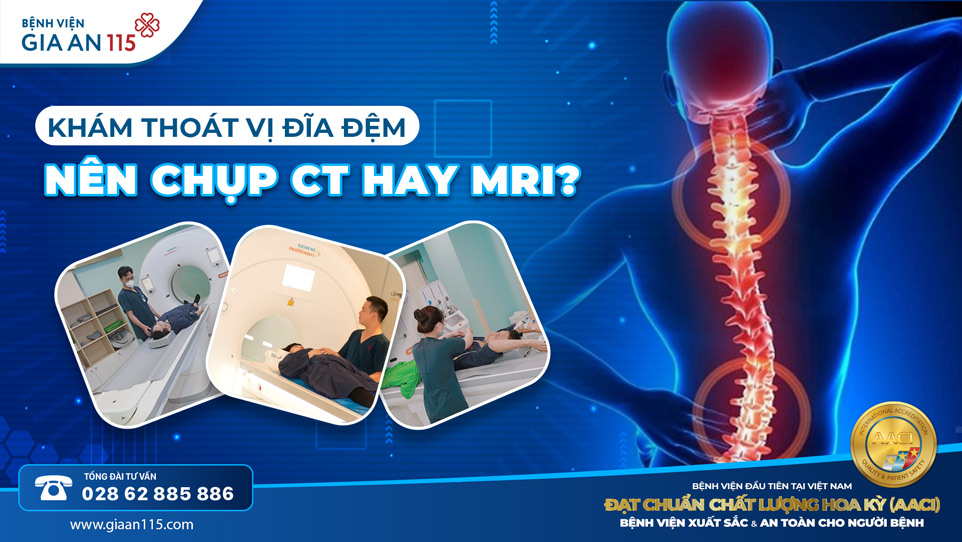 Khám thoát vị đĩa đệm: Nên chụp CT hay MRI?