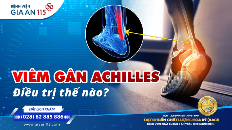 Đau phía trên gót chân - viêm gân Achilles