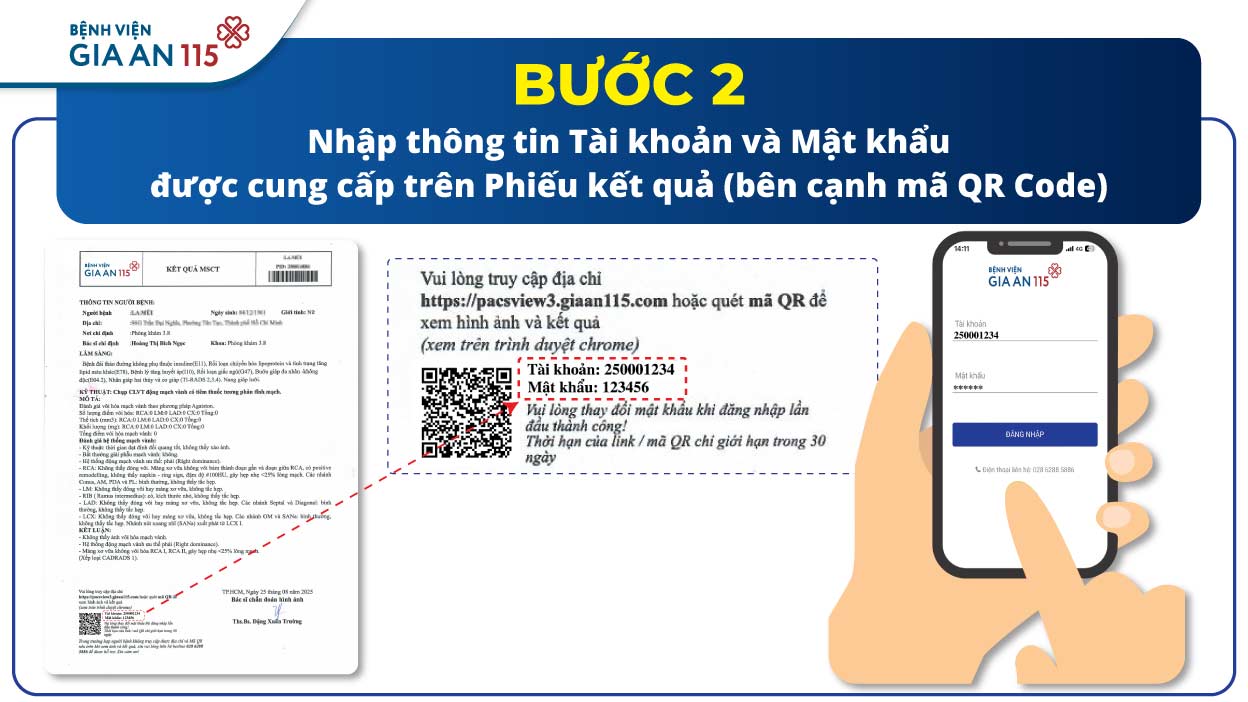 Sử dụng hệ thống PACS để lưu hình ảnh, không in phim - Buoc 2
