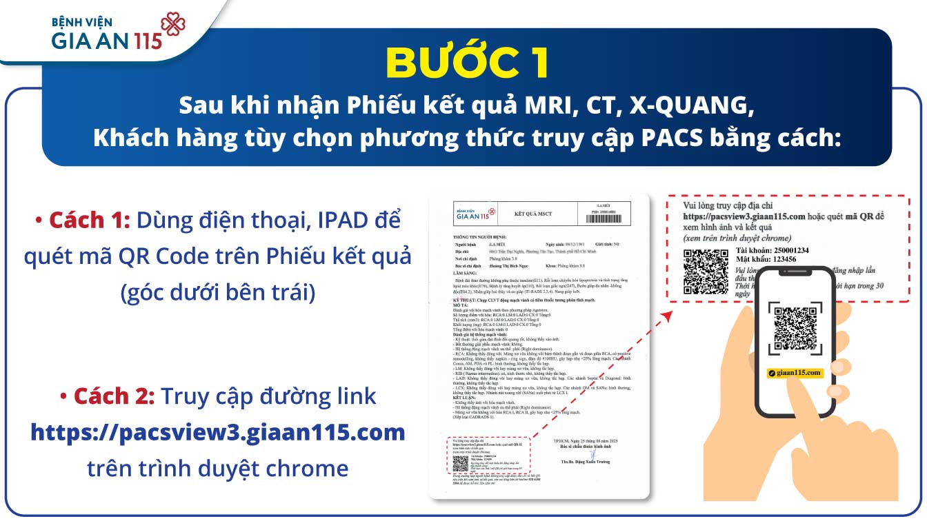Sử dụng hệ thống PACS để lưu hình ảnh, không in phim