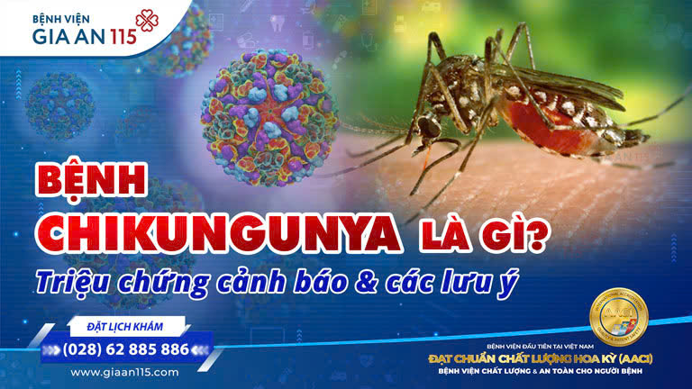 Bệnh Chikungunya là gì