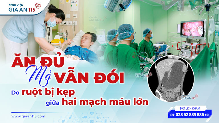 Phẫu thuật hội chứng động mạch mạc treo tràng trên