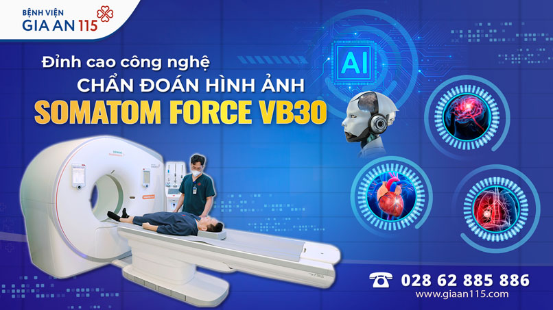 SOMATOM Force VB30 – Đỉnh cao công nghệ chẩn đoán hình ảnh 